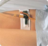 EA/1 FOLEY CATH HOLDER, LEG BAND 2IN X 19.5IN