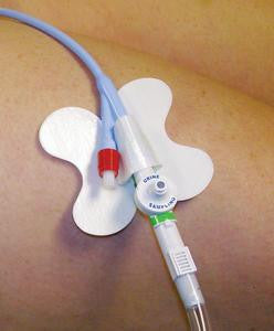 EA/1 CATH-SECURE MULTI-PURPOSE TUBE HOLDER 2 1/2IN WRAP TAB, BUTTERFLY BASE